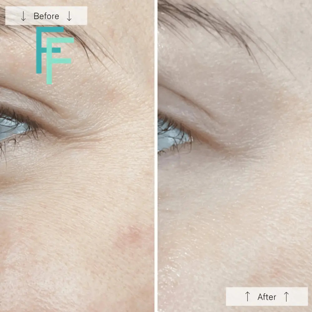 Omnilux Contour - Anti-Ageing Led Light Therapy