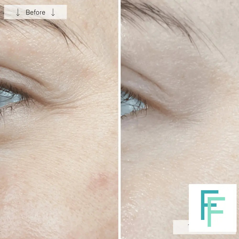 Omnilux Contour - Anti-Ageing Led Light Therapy