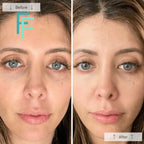 Omnilux Contour - Anti-Ageing Led Light Therapy