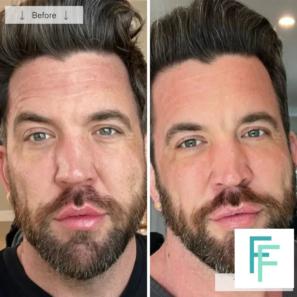 Omnilux Men- Anti-Ageing Led Light Therapy