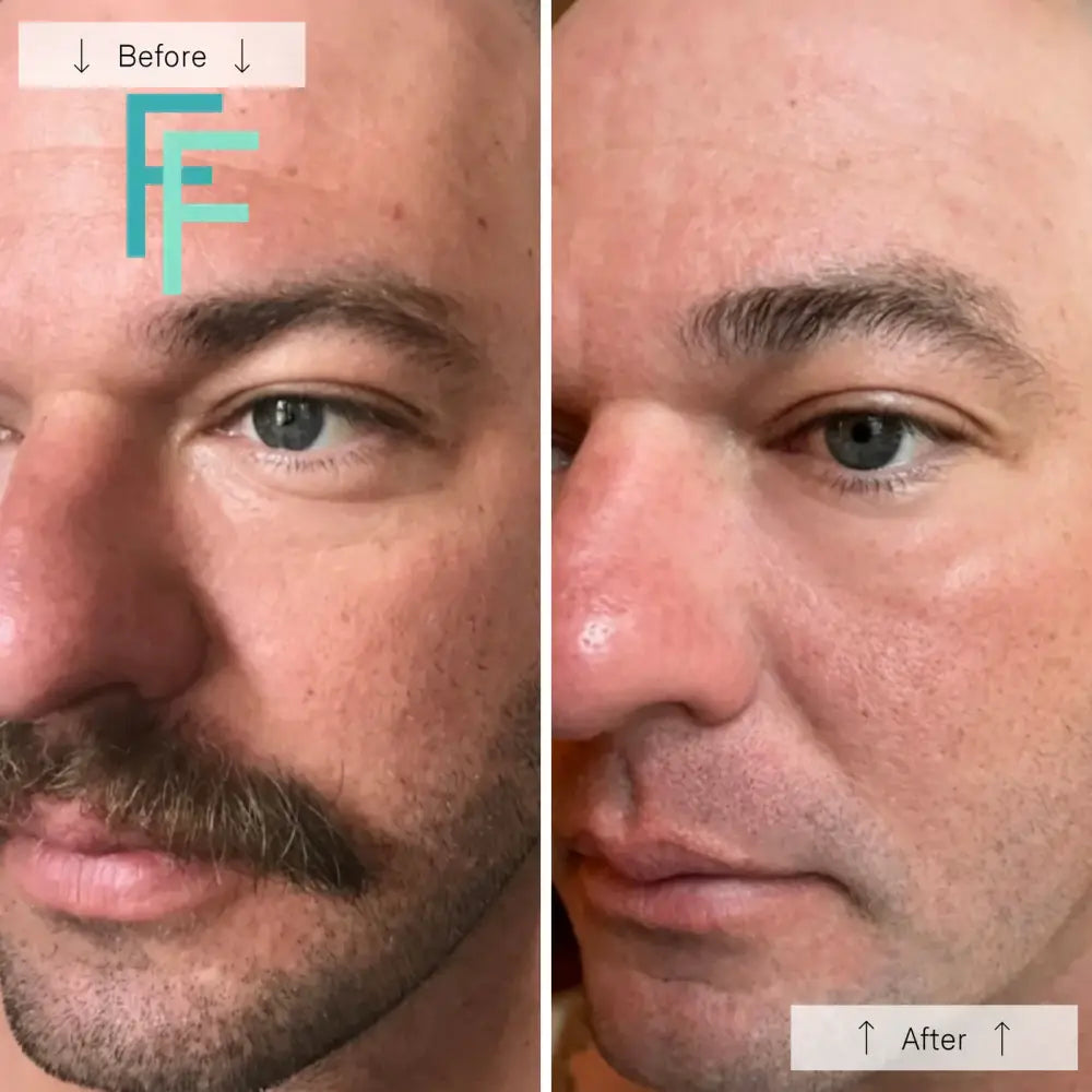 Omnilux Men- Anti-Ageing Led Light Therapy