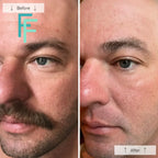 Omnilux Men- Anti-Ageing Led Light Therapy