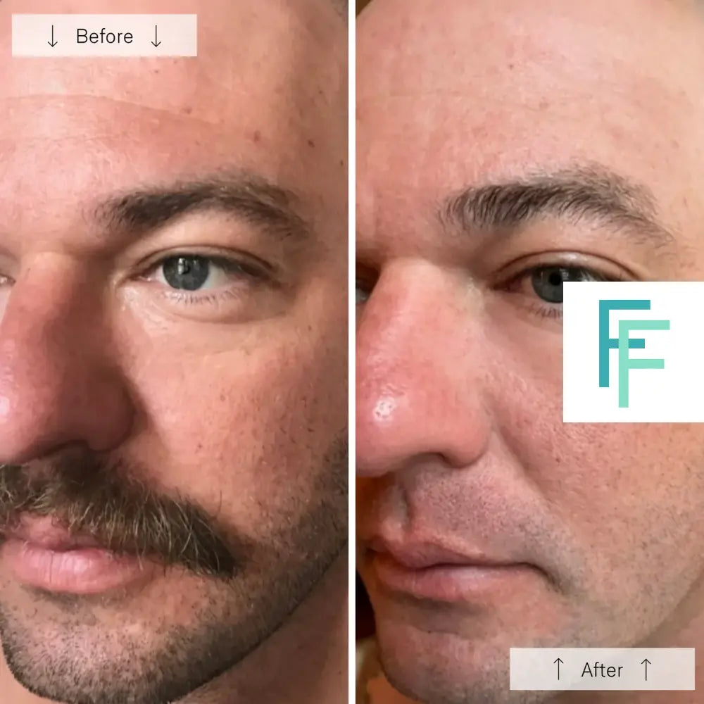 Omnilux Men- Anti-Ageing Led Light Therapy