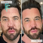 Omnilux Men- Anti-Ageing Led Light Therapy