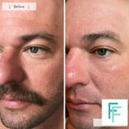 Omnilux Men- Anti-Ageing Led Light Therapy
