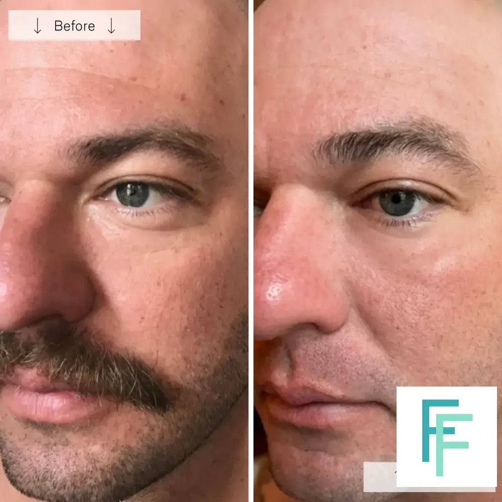Omnilux Men- Anti-Ageing Led Light Therapy