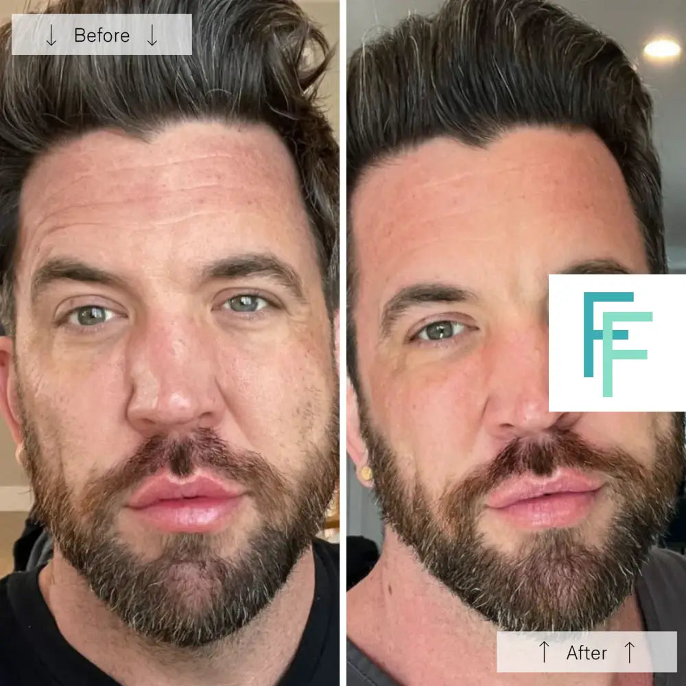 Omnilux Men- Anti-Ageing Led Light Therapy